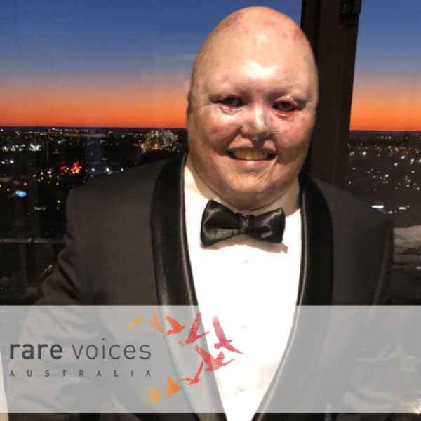 Photo of Dean wearing a suit and bow tie